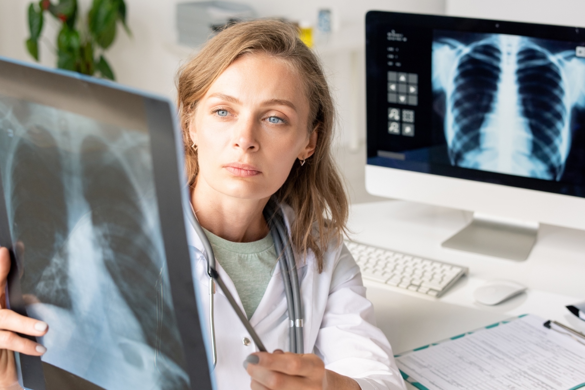 Комп'ютерна томографія легенів